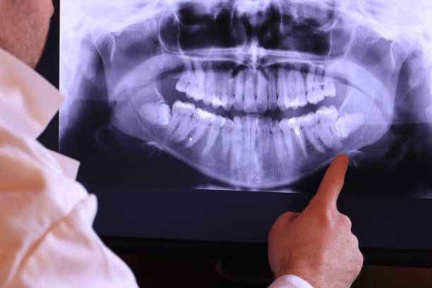 Best Emergency Dentist for Special Needs Patients in Burien, WA