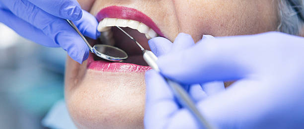 Best Emergency Dental Extractions in Burien, WA